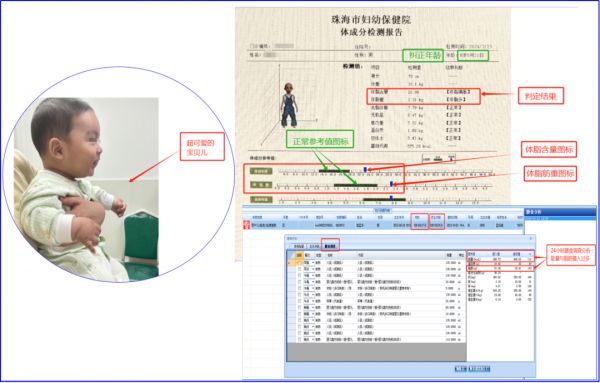 最新指南来了！专家教您如何科学给「胖宝宝」减重