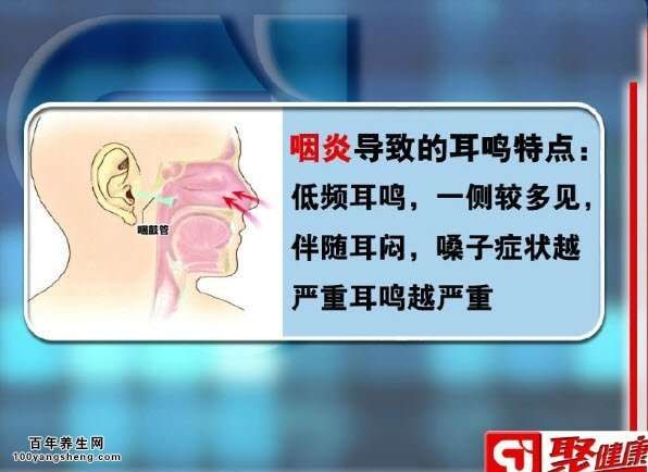 咽炎導(dǎo)致的耳鳴特點