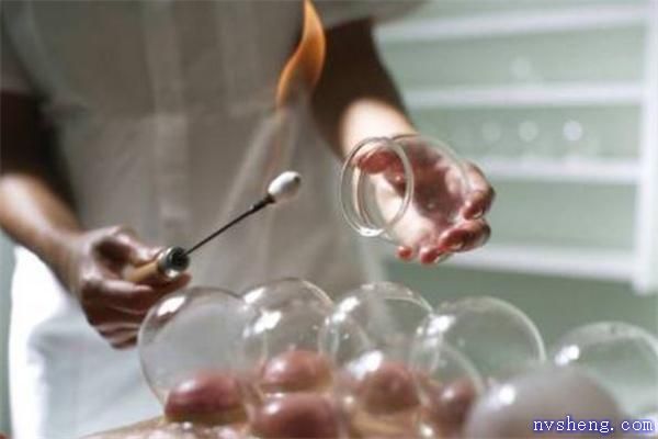 拔罐减肥是天天拔吗 拔罐减肥多久拔一次