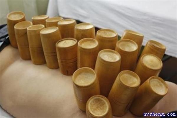 拔罐减肥是天天拔吗 拔罐减肥多久拔一次