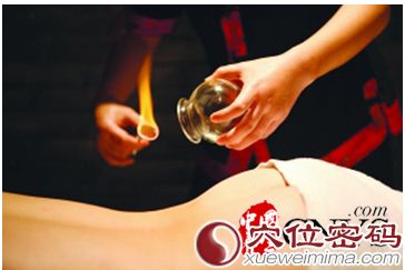 中醫(yī)養(yǎng)生 詳解拔罐減肥方法及注意事項(xiàng)
