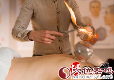 中醫(yī)養(yǎng)生 詳解拔罐減肥方法及注意事項(xiàng)