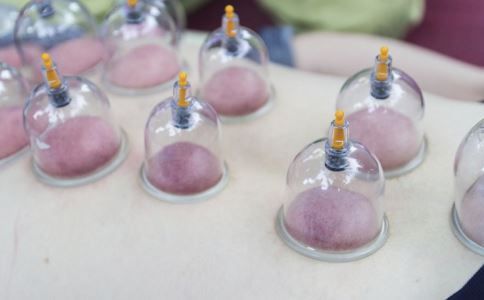 中医拔罐有哪些好处 拔罐的养生功效 拔罐的好处有哪些