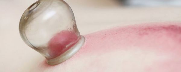 拔罐能去除體內(nèi)濕氣嗎 拔罐的功效 拔罐的好處