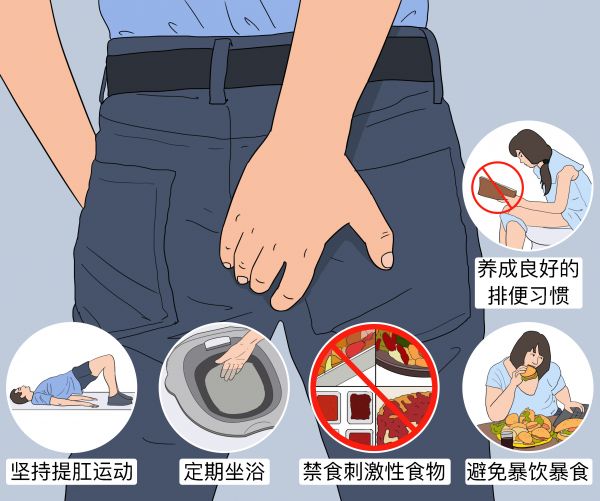 痔瘡注意事項(xiàng)及飲食禁忌.jpg