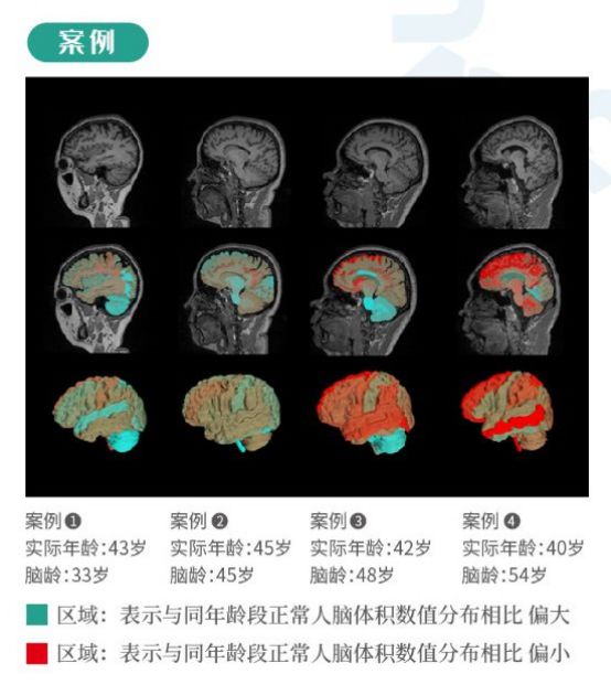 全景醫(yī)學(xué)新技術(shù)實現(xiàn)影像診斷新跨越 智慧預(yù)警 護(hù)航健康04021096.png