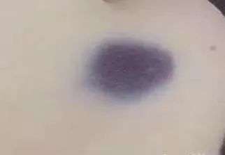 32171690326778770