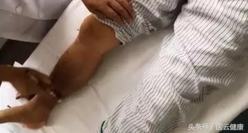 中醫(yī)艾灸治療糖尿病，調(diào)節(jié)血糖，改善并發(fā)癥！