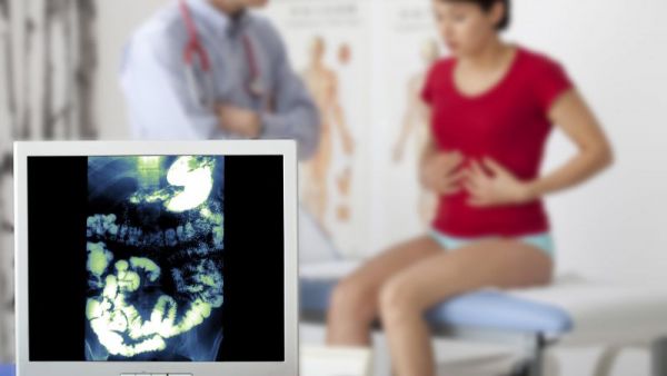 腸粘連的保健護理
