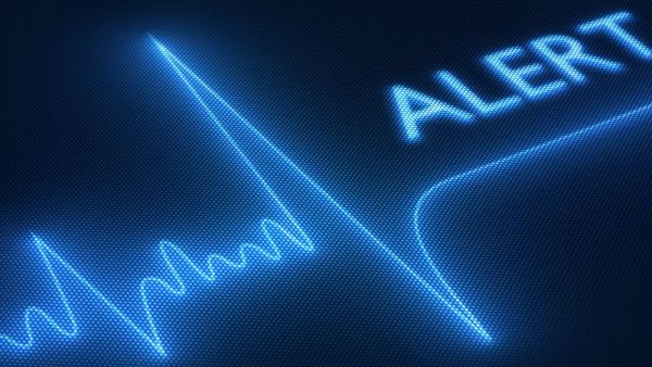 24h动态心电图心率失常是什么