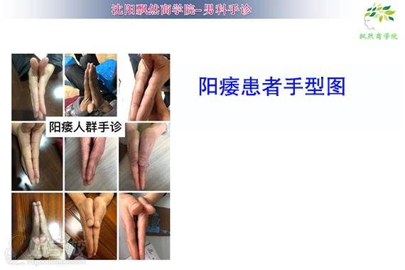 手型案例