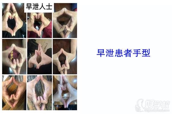 手型案例