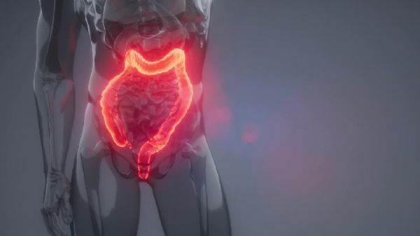 潰瘍性結(jié)腸炎的主要護理措施