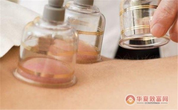 拔罐減肥培訓加盟
