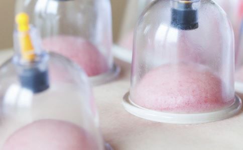 拔罐后皮肤颜色鉴别反映身体状况 拔罐反应身体状况 拔罐看身体状况