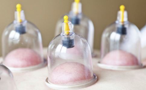 拔罐后皮肤颜色鉴别反映身体状况 拔罐反应身体状况 拔罐看身体状况