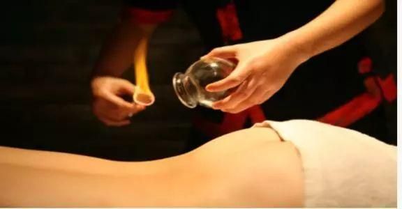 拔罐方法不對=縮短生命？老中醫(yī)提醒，拔火罐前一定要看！