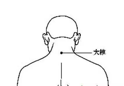 拔罐方法不對=縮短生命？老中醫(yī)提醒，拔火罐前一定要看！