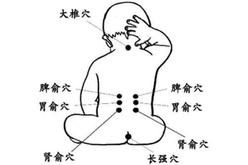 拔罐方法不對=縮短生命？老中醫(yī)提醒，拔火罐前一定要看！