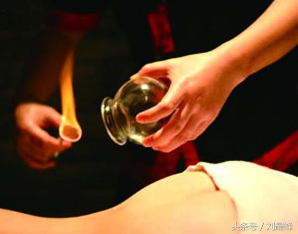 中醫(yī)拔罐養(yǎng)生，您了解多少？