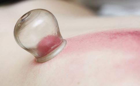 拔罐穴位图 拔罐穴位 拔罐穴位位置