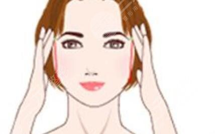 面部吸脂手術多久可以恢復？恢復時間+真人面部吸脂案例