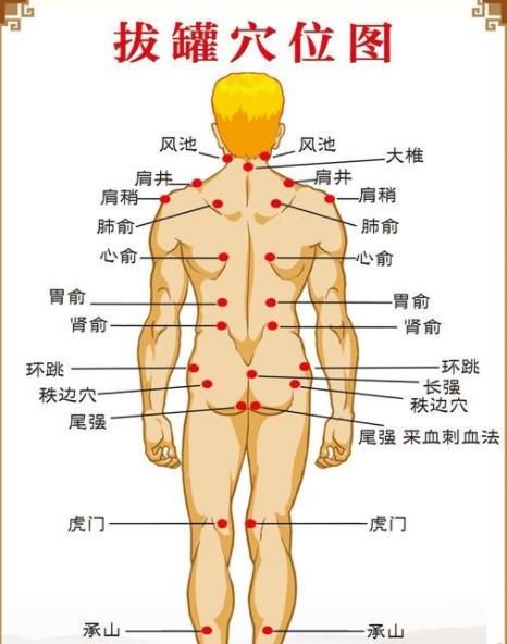 拔罐圖片 穴位