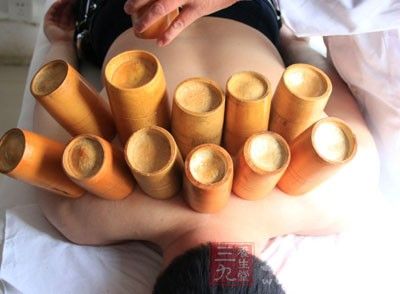 專家介紹，拔罐的原理就是改善局部血液循環(huán)，并使體內(nèi)毒素排出