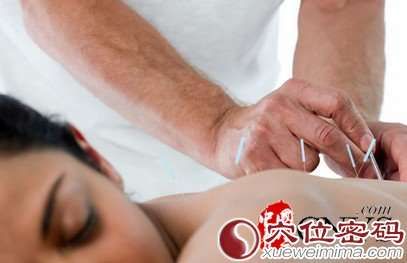針灸減肥前十點(diǎn)須知