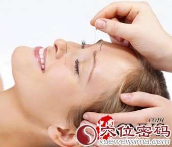 針灸減肥前十點(diǎn)須知
