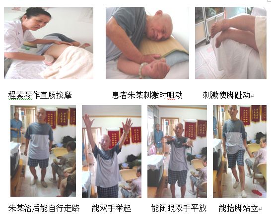 程素琴醫(yī)師 運用反射療法與尾椎直腸全息按摩治愈八例