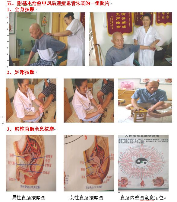 程素琴醫(yī)師 運用反射療法與尾椎直腸全息按摩治愈八例