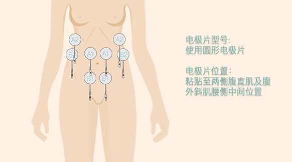 靜息肌電高