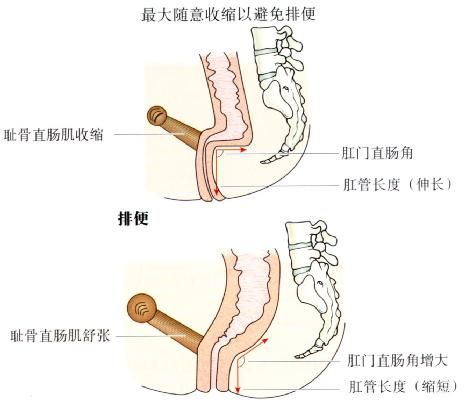 肛門直腸角
