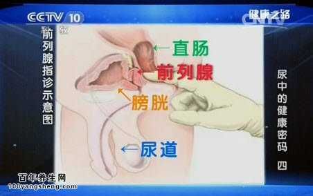 直肠指检可以发现早期前列腺癌