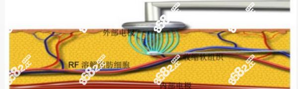 寶麗太