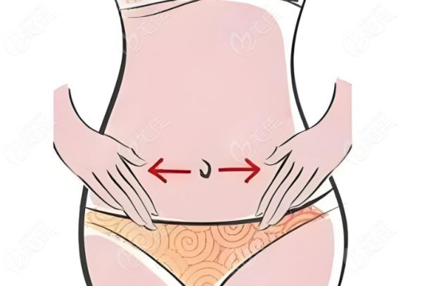 北京腹壁成型哪家医院做得好？www.236z.com