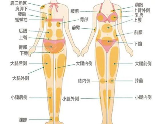 全身吸脂具體吸哪些部位的示意圖.jpg