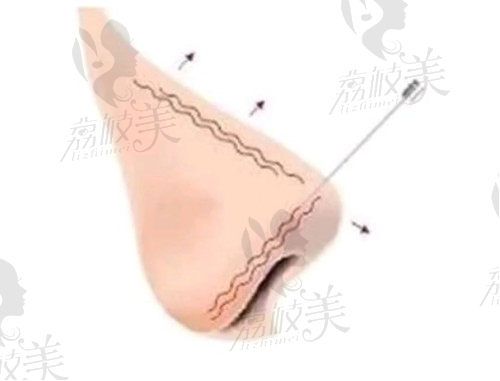 广州整形美容价格贵吗
