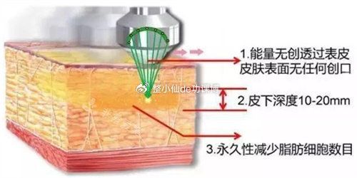 5G天使光雕