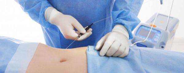 5g光雕跟水動力吸脂哪個好