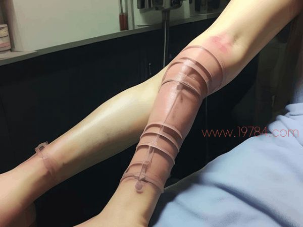 手臂怎么抽脂(手臂抽脂真實經(jīng)歷) 第2張