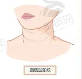 上海超聲溶脂瘦腰腹醫(yī)院哪家好? 匯總10家口碑技術(shù)好的醫(yī)院