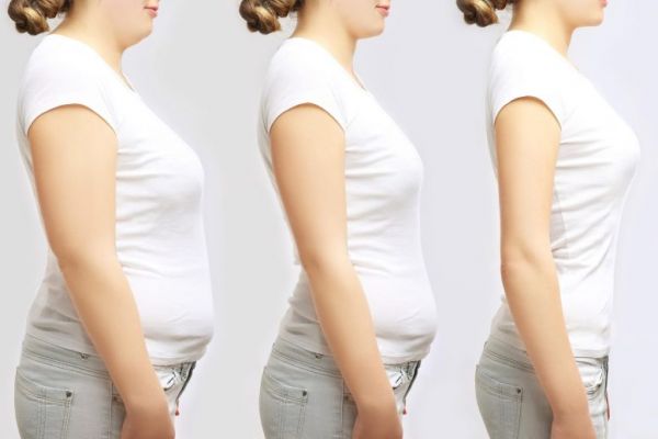 Obesity-Weight-Loss-Concept-1-777x518.jpg