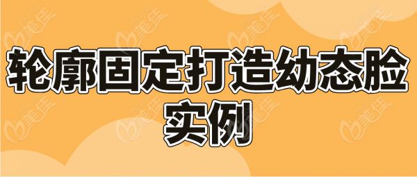 輪廓固定打造幼態(tài)臉實例分享