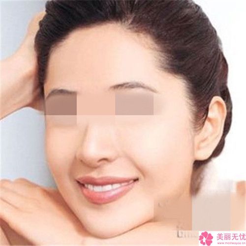 正規(guī)面部抽脂機(jī)構(gòu)推薦：面部抽脂醫(yī)院前30都是哪些機(jī)構(gòu)