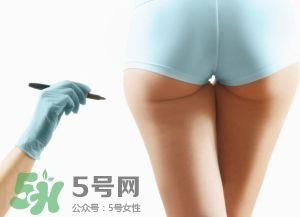 吸脂減肥副作用有哪些？吸脂減肥可靠嗎？