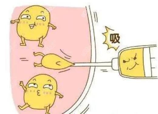 個(gè)人吸脂真實(shí)體驗(yàn)感受