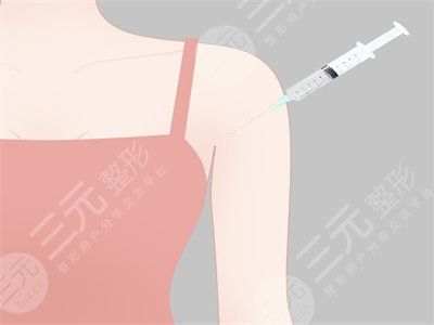 手臂吸脂整形手术前后对比照 手臂抽脂减肥全过程