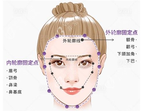 內(nèi)外輪廓固定圖示